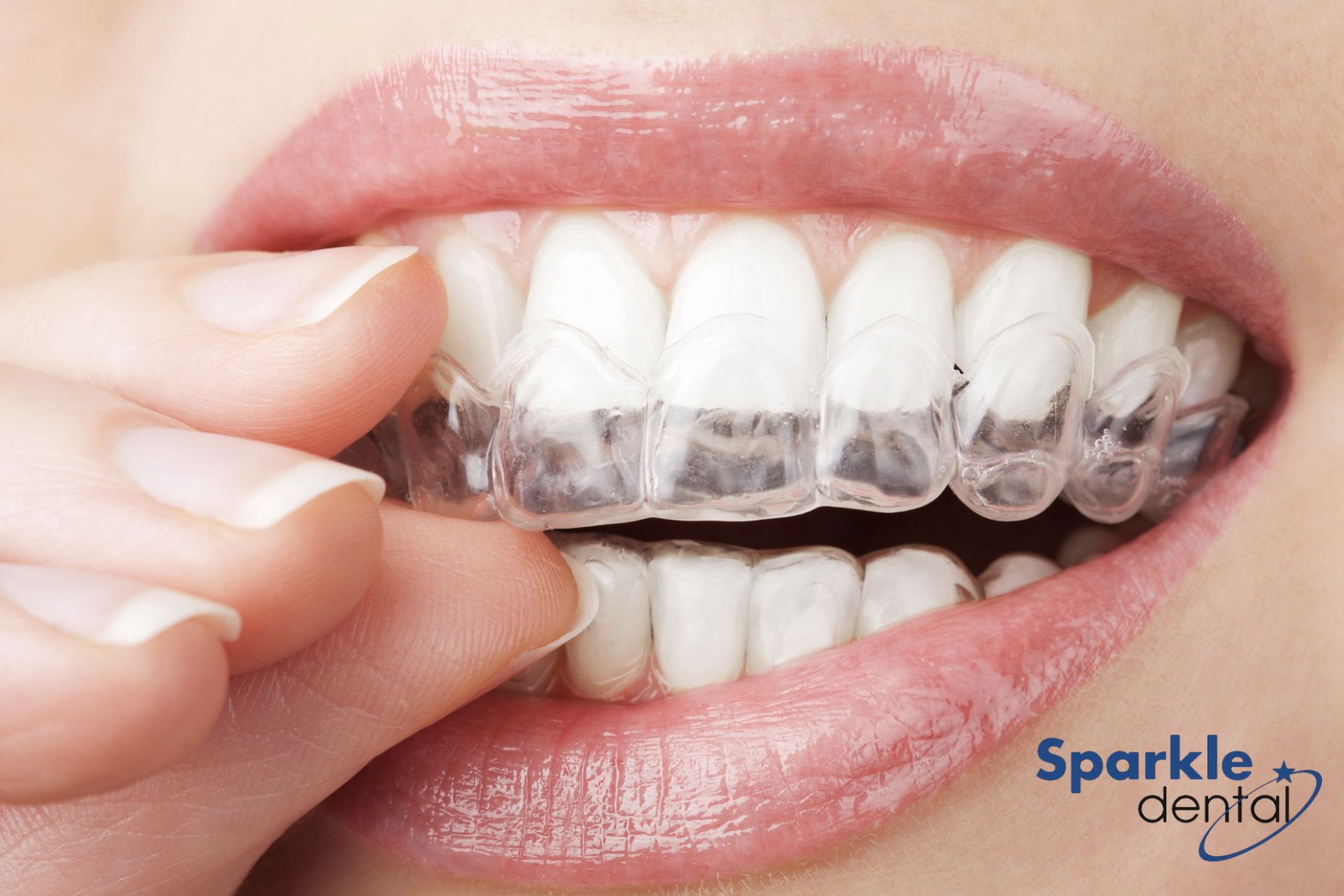 Invisalign For Adults Hero Invisalign For Adults Hero
