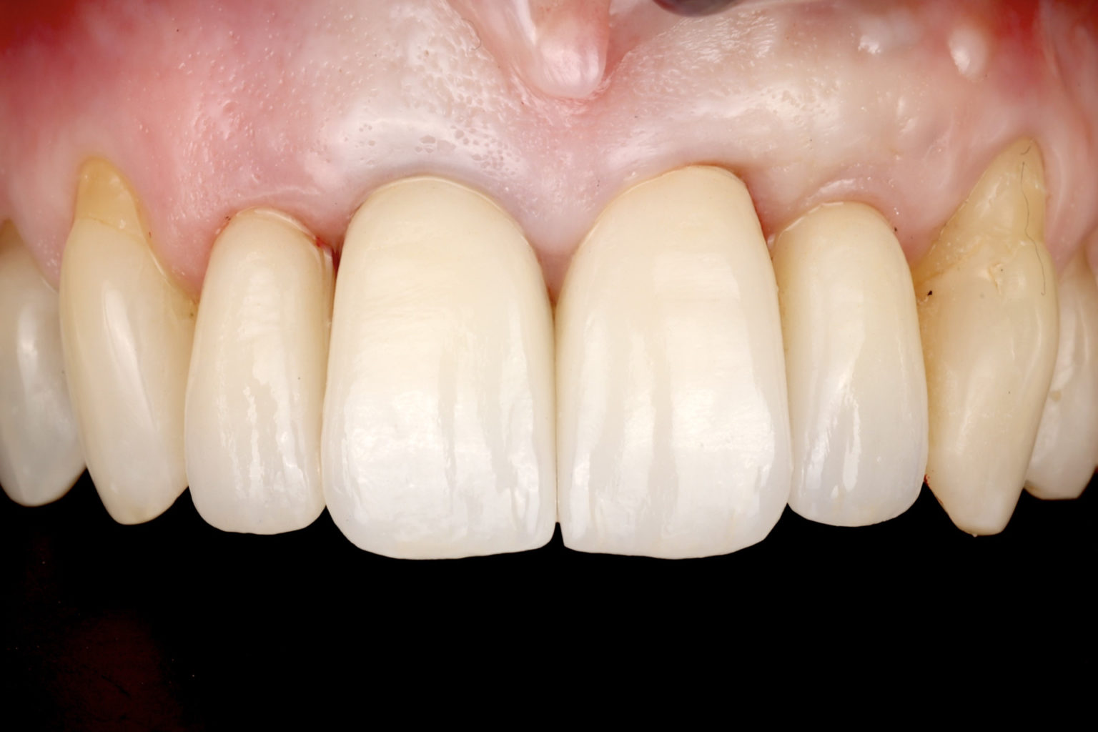 Smile makeovers Joondalup Cosmetic Dentist Sparkle Dental