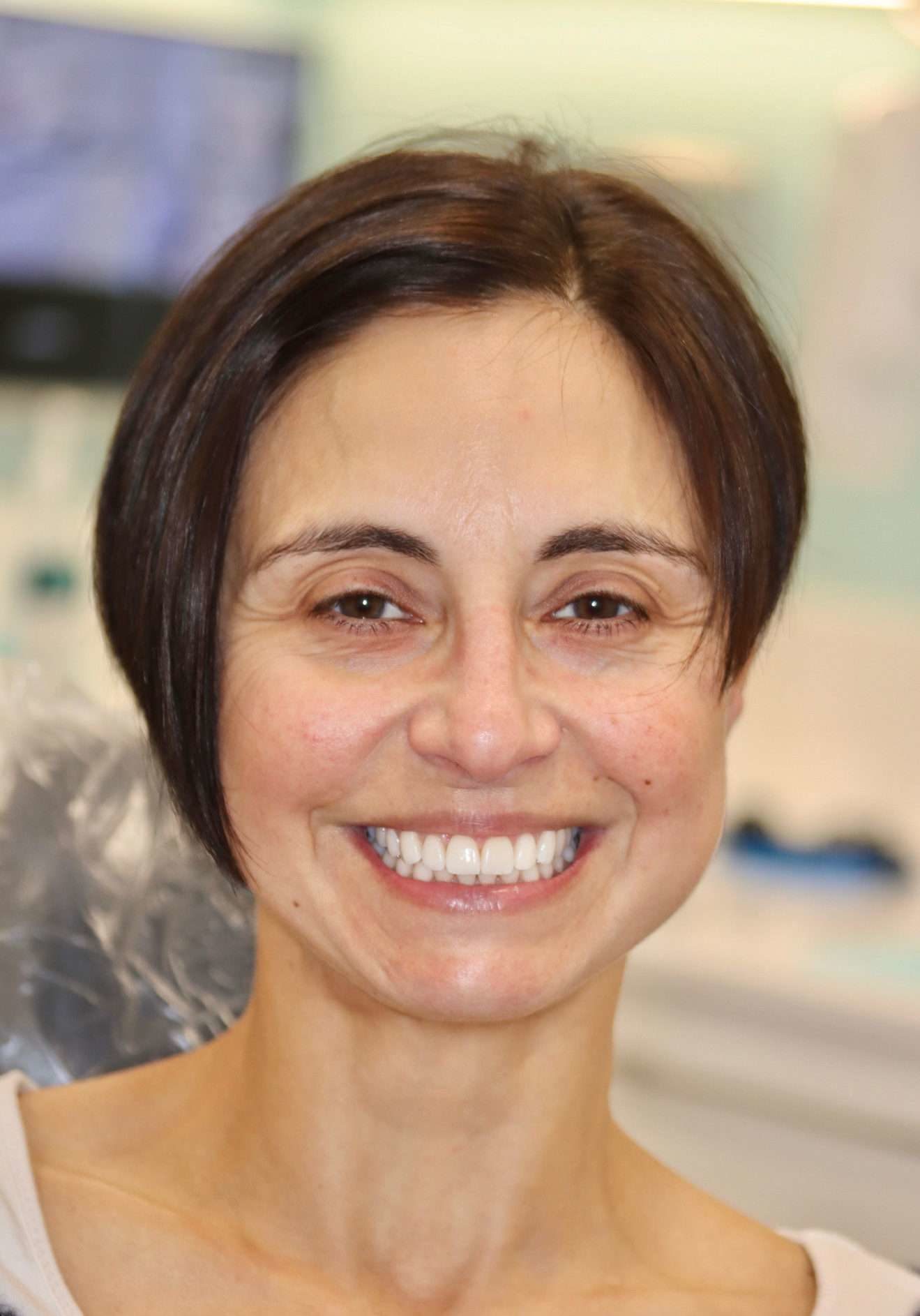 A2956e0e Fbcb 4e91 A0f0 9e8707844851 Portrait After smile makeover treatment