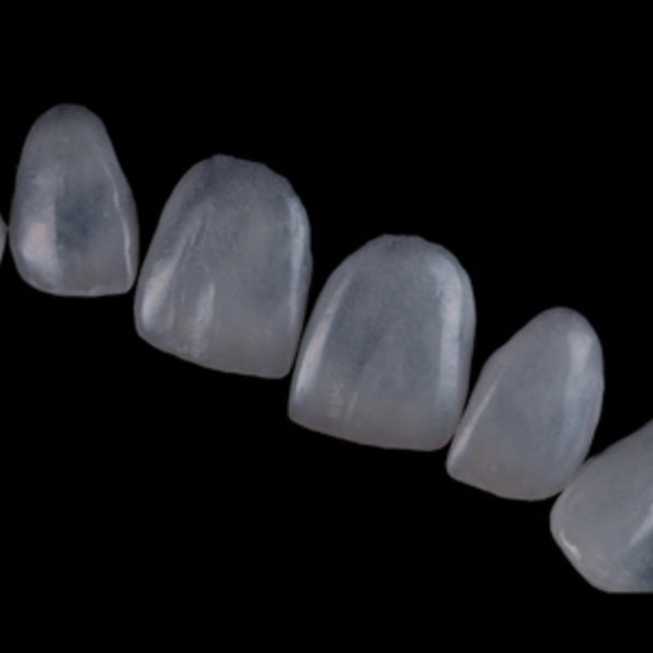 Porcelain veneers at Sparkle Dental