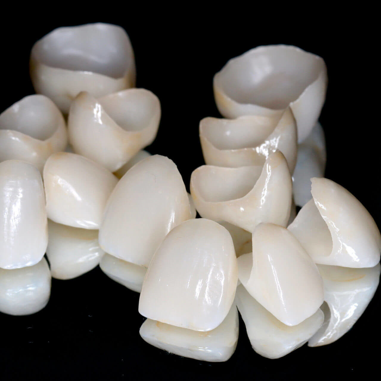 Personalised ceramic dental crowns